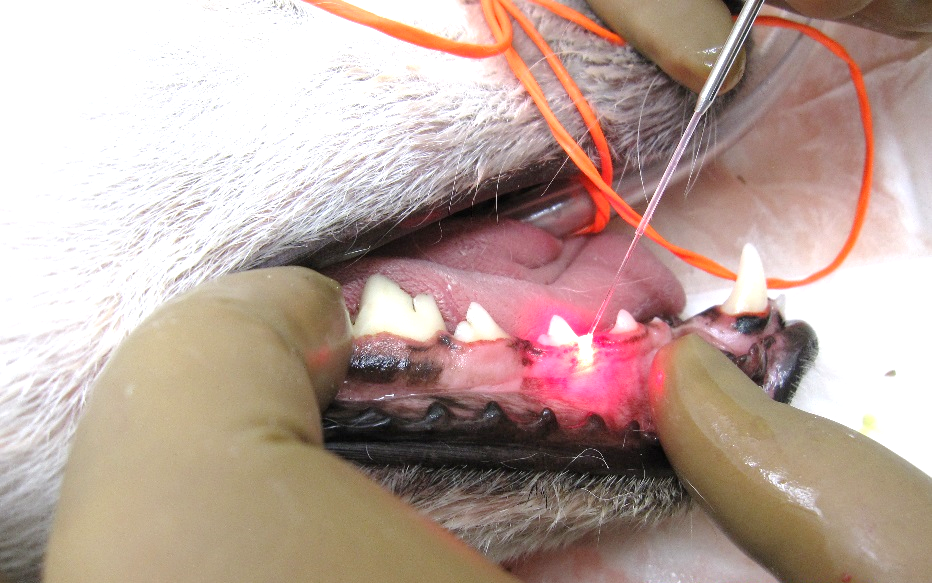歯肉縁下レーザー治療